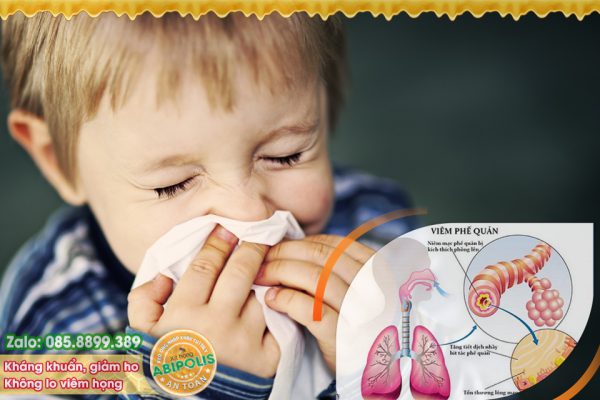 Cảnh báo - Trẻ viêm phế quản hay tái phát, sau dễ gặp vấn đề về phổi