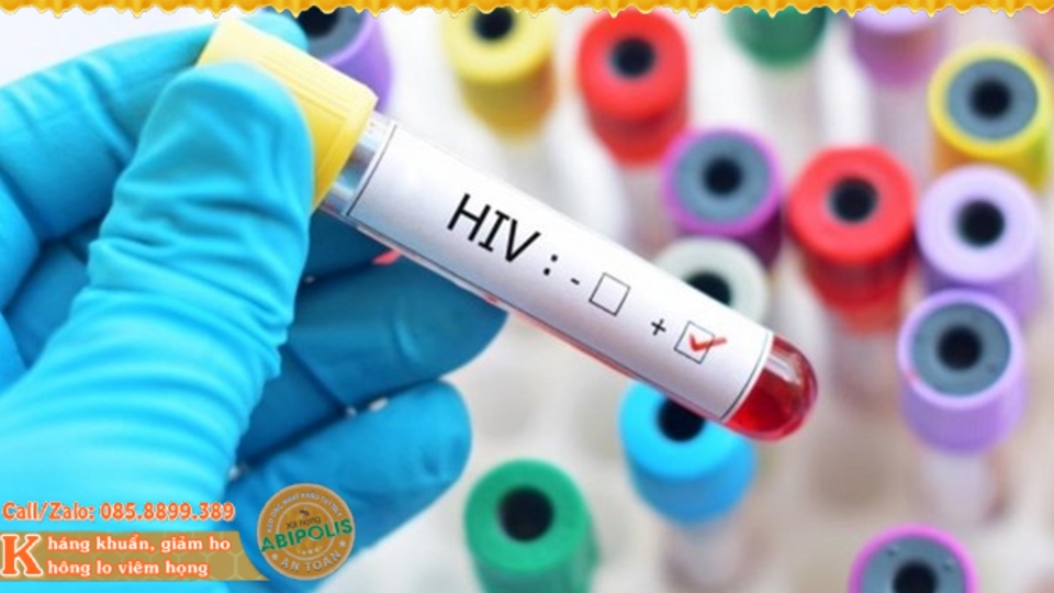 Cảnh báo HIV- Ho khan là dấu hiệu ban đầu cần chú ý