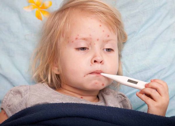 Cảnh báo 3 sai lầm khiến bệnh sốt xuất huyết trở nặng